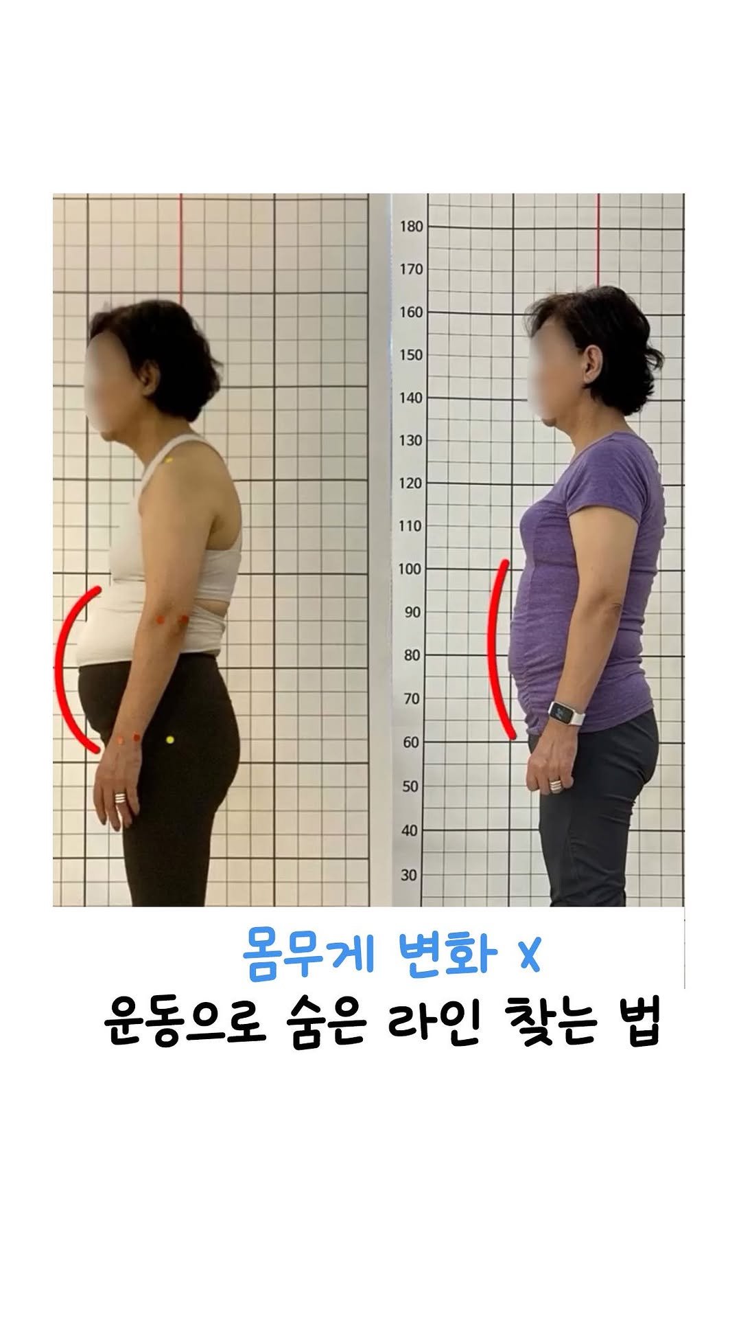 jinadoit 게시물 이미지: 저희 회원님 2주 전에 이랬는데
지금 이렇게 변하셨어요👀
뱃살이 빠진 것도...