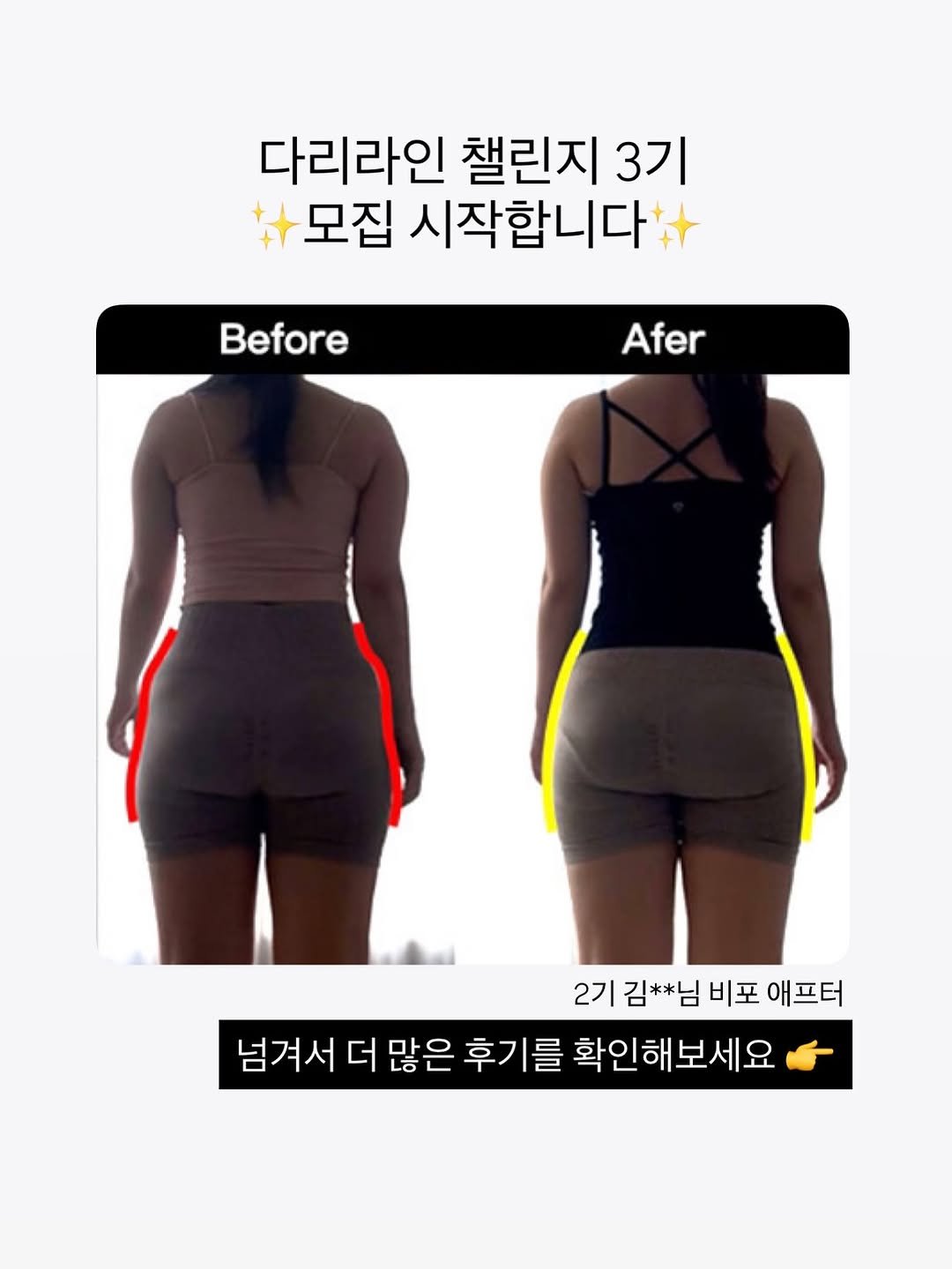Photo by 지나두잇ㅣ다이어트 • 체형개선 on September 08, 2025. May be an image of 2 people and text that says '다리라인 챌린지 3기 모집 시작합니다 Before Afer 2기 김**님 비포 애프터 넘겨서 더 많은 후기를 확인해보세요'.
