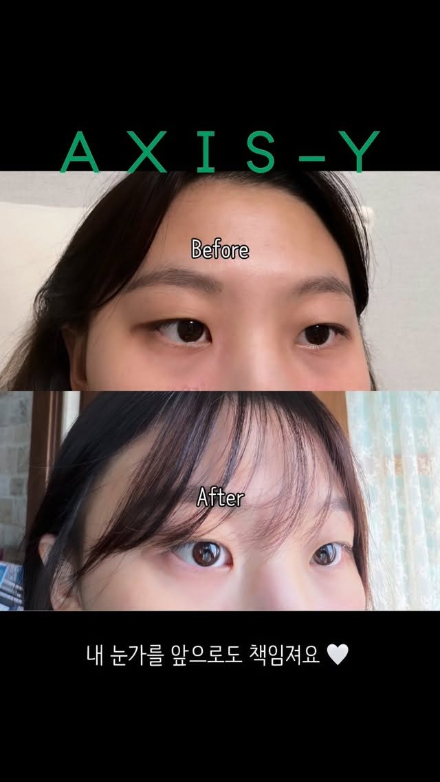 jinjung_couple 게시물 이미지: 아침마다 피곤해 보이는 눈가라면
오늘부터 이거 ✨

쿨링 마사지 + 비건...