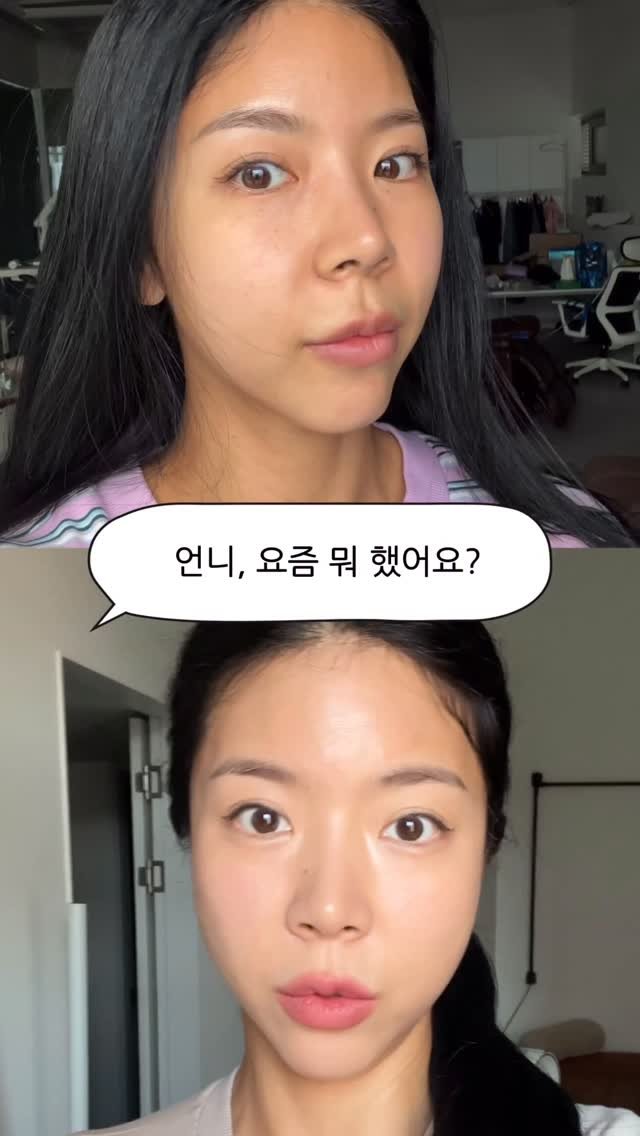 jjeuneu 게시물 이미지: 근 5년간 받았던 시술 애프터 중 가장 마음에 드는 애프터💖
요즘 저 얼굴은...