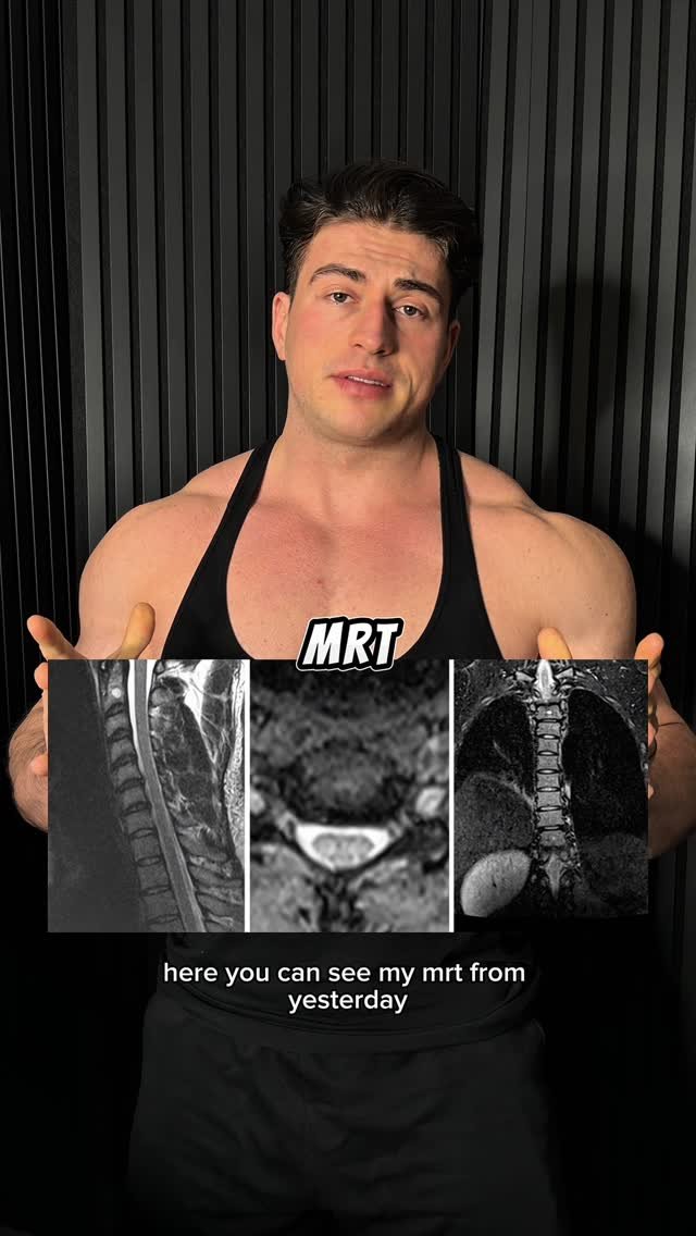 johnymuenster 게시물 이미지: Ich wünschte es gäbe eine andere Lösung!😕
Am...