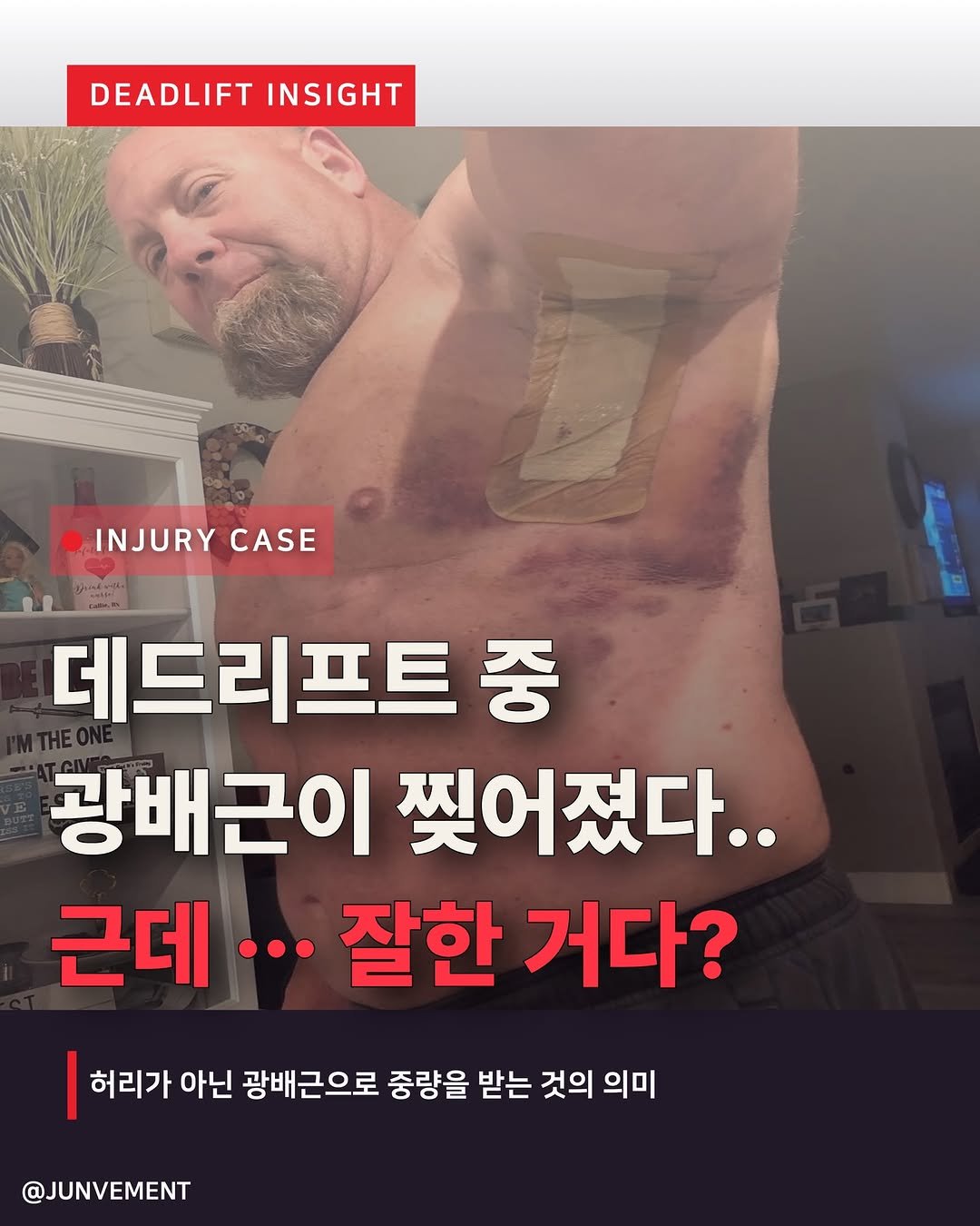 junvment 게시물 이미지: 🚨데드리프트 중 광배근이 찢어졌다.
🤔근데 이게 왜 잘한 건지 아세요?

무게를...