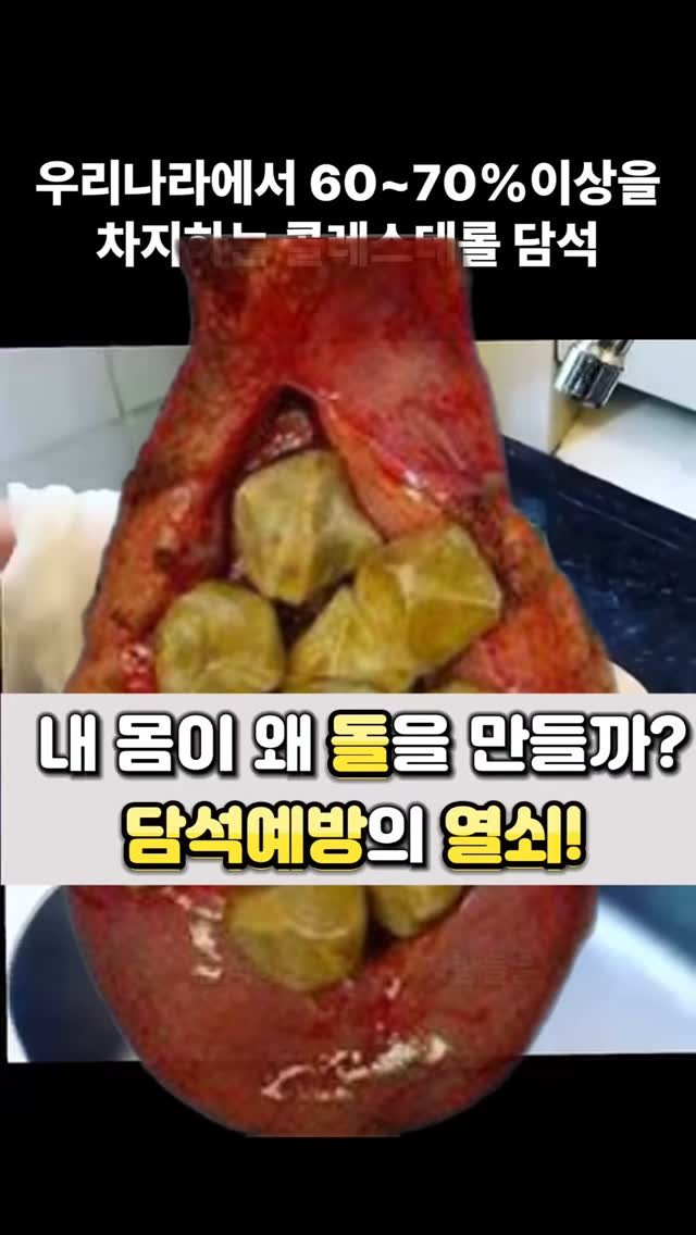 juny_yaksa 게시물 이미지: 저의 아버지께서 6월부터지금까지 수용성 커큐민과 애사비의 조합으로 된것을 하루2포씩...