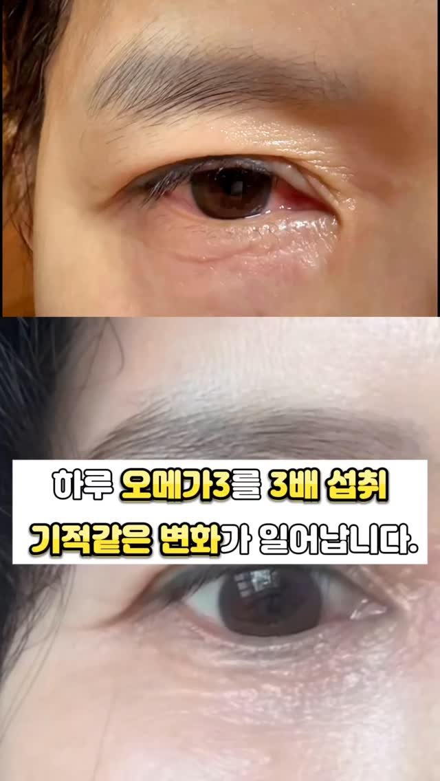 juny_yaksa 게시물 이미지: “소중하지 않은 장기가 어디 있을까요?”

요즘 저는 이 질문을 자주...