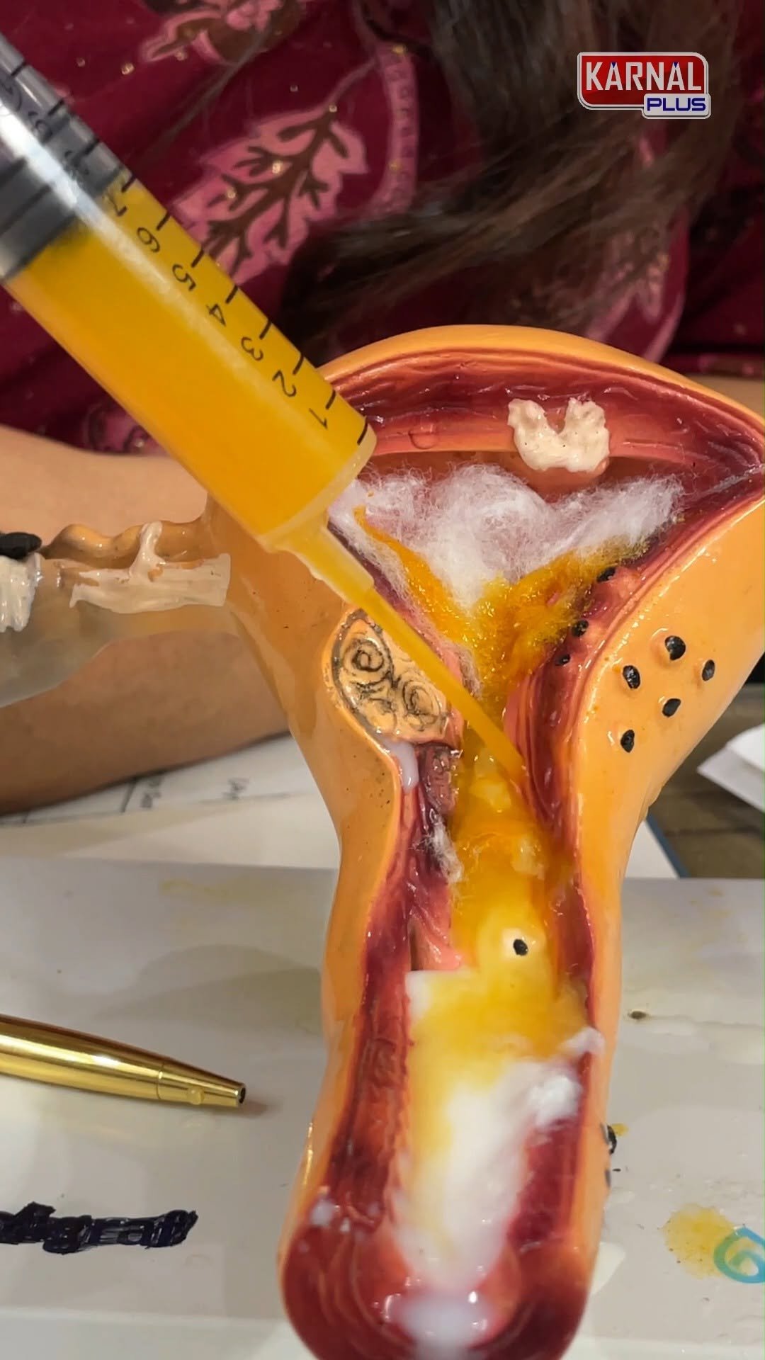 karnalplus 게시물 이미지: 🤰 Infertility से परेशान? ये उपाय बदल देंगे...