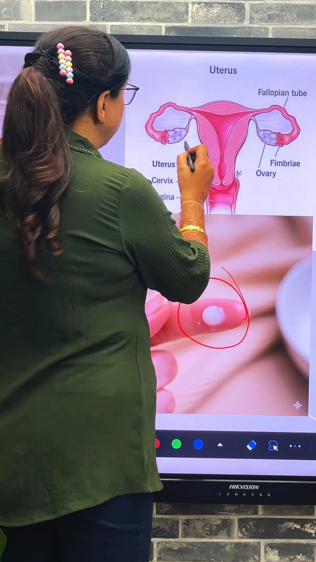 karnalplus 게시물 이미지: 💧क्या कारण है सफेद पानी का कैसे पीछा छुड़ाए जानिए 💫