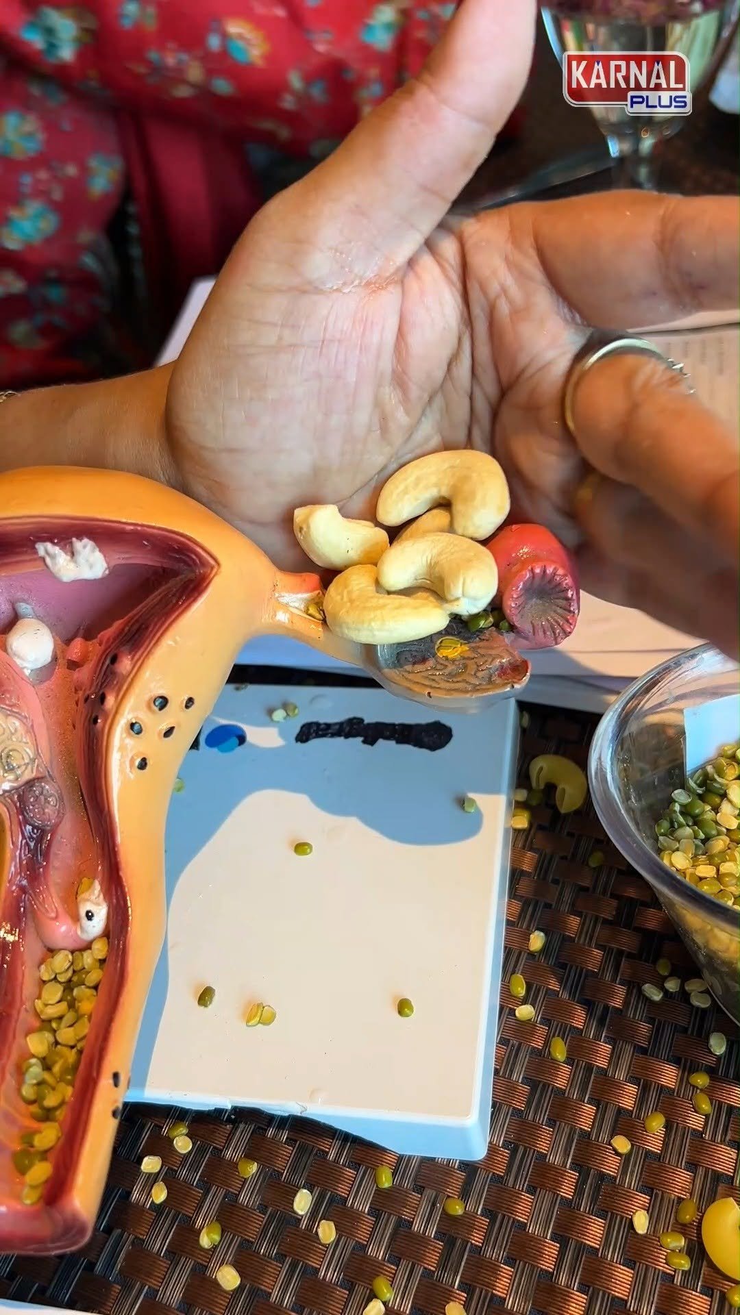 karnalplus 게시물 이미지: PCOD PCOS से परेशांन है महिलाएं क्यों जानें...