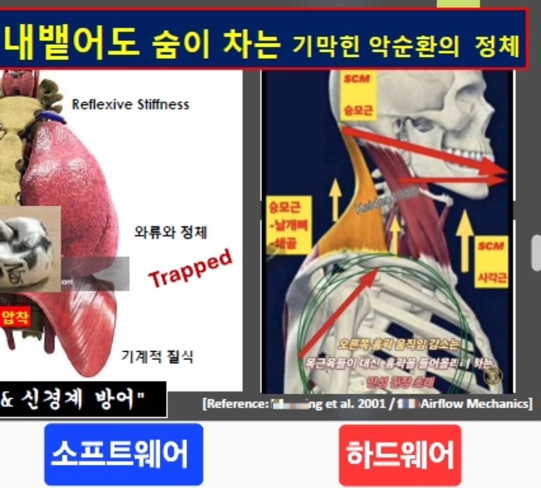 keiden1980 게시물 이미지: "비워야 채운다?" 허울 좋은 말이죠.
날숨을 아무리 해도 안 되는데요?
🟡...