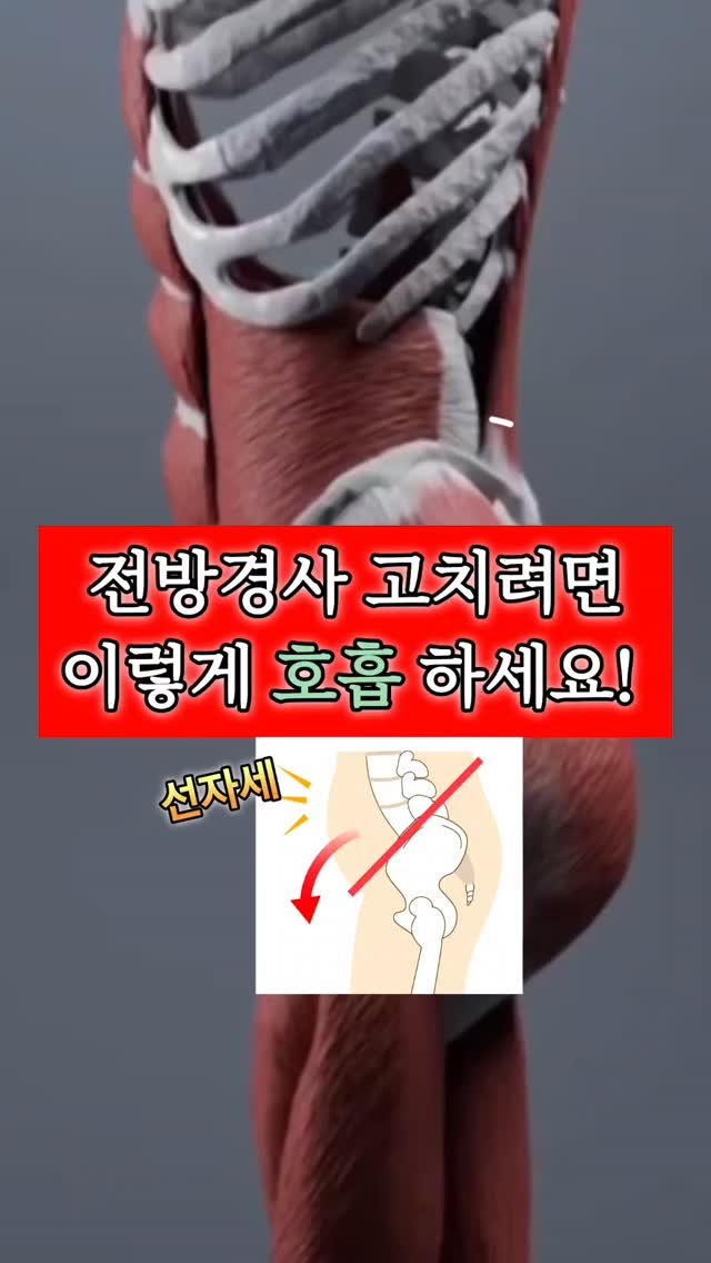 keiden1980 게시물 이미지: 😡 ​전방경사 고치려면 무작정 골반만 말지 마세요

​바른 자세를 하려다 나도...
