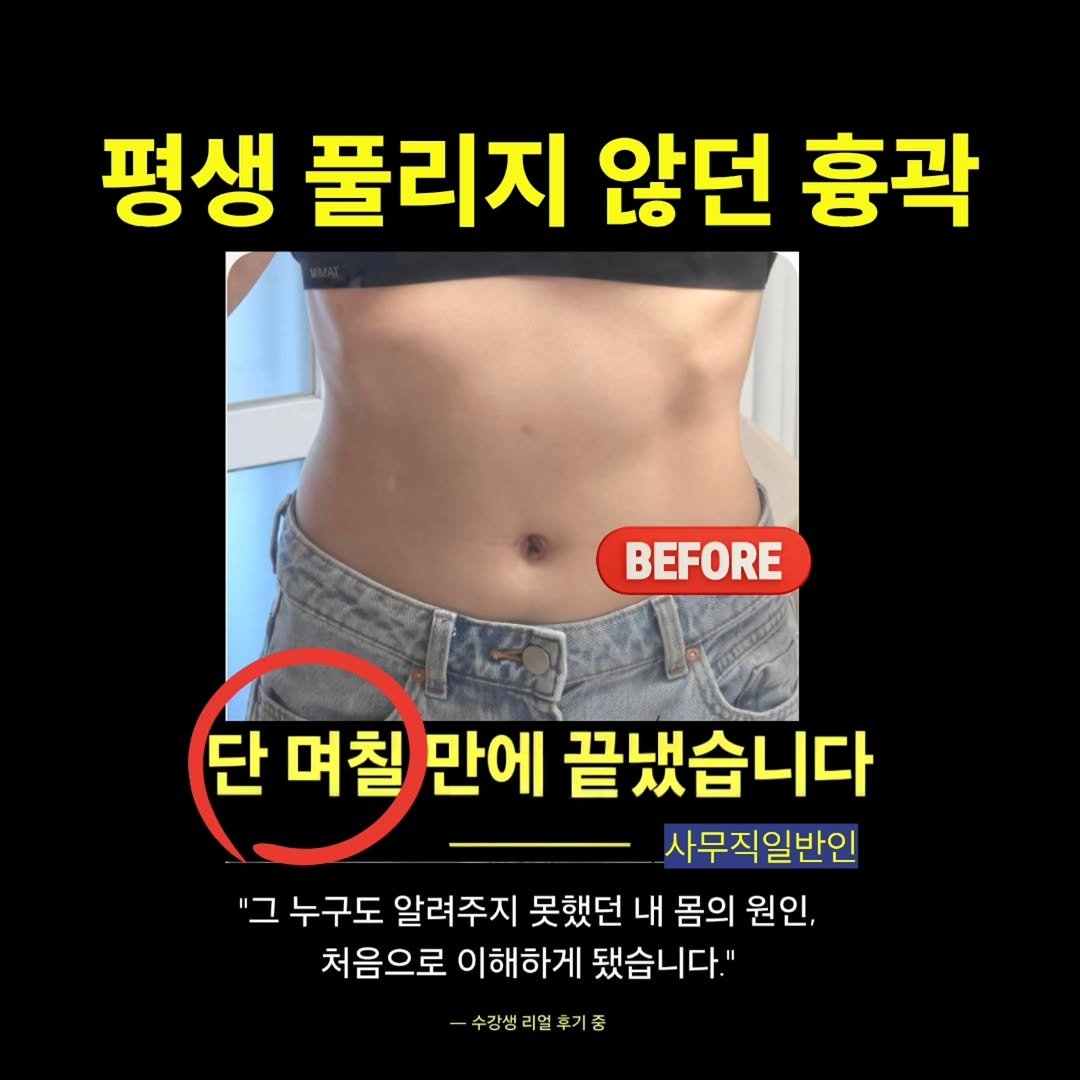 keiden1980 게시물 이미지: 🩻 평생의 불편함 - 💥 단 3일 만에 ! 그 이유
단순히 살이 빠진 걸까요?...