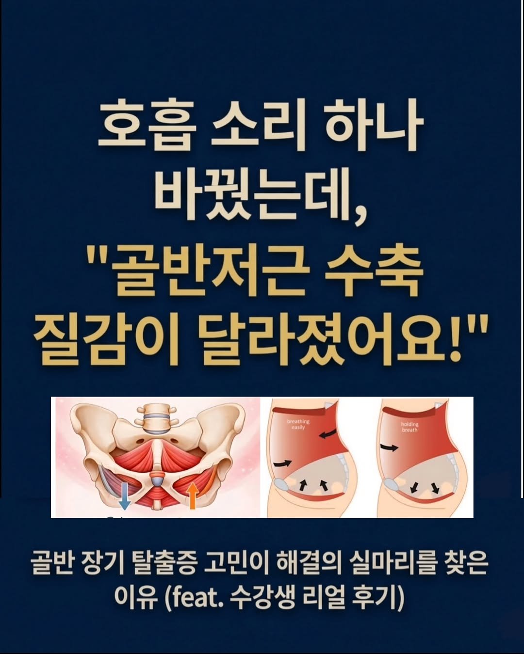 keiden1980 게시물 이미지: 💨 [호흡 소리가 바뀌면, 골반의 운명이 바뀝니다]

선생님들, 혹시 하부 복근을...