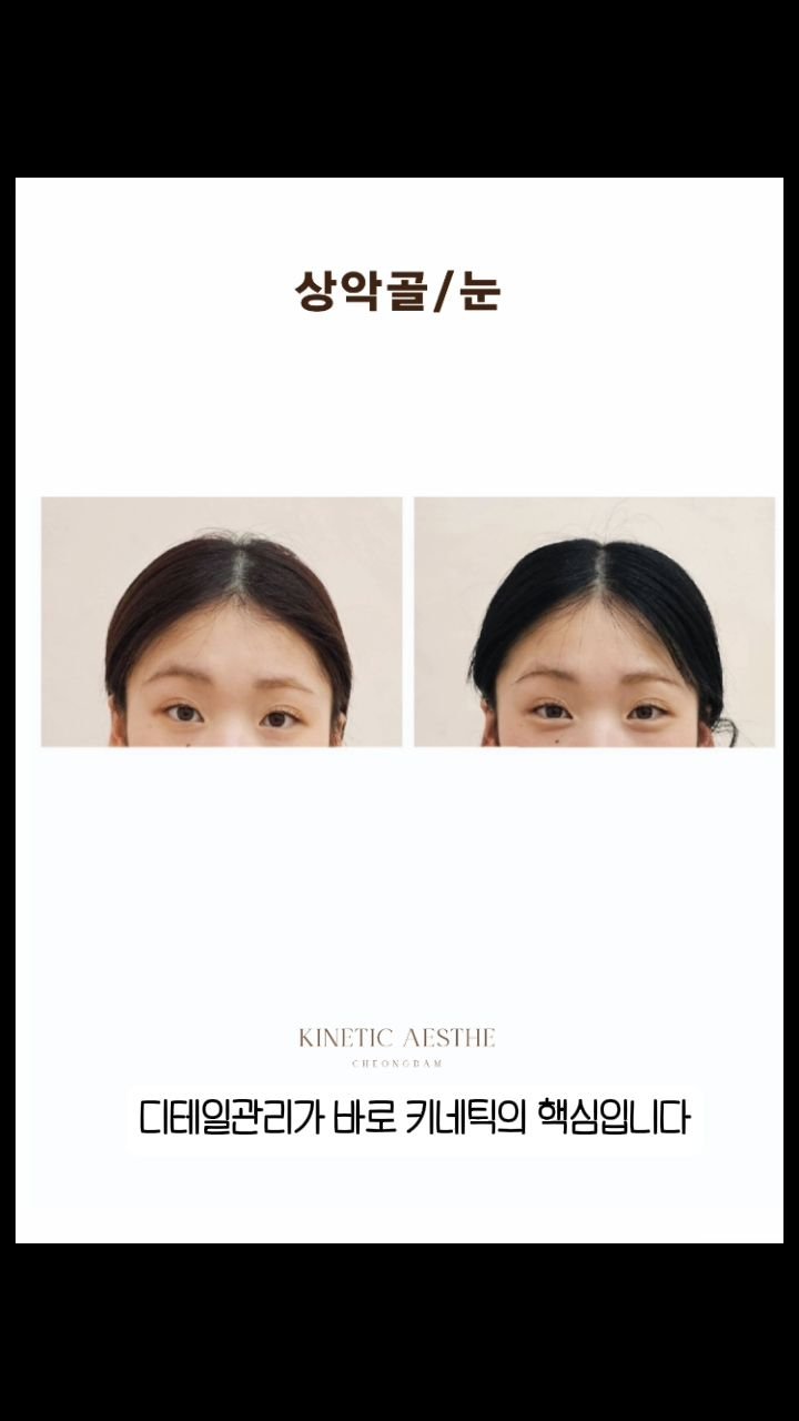 kinetic_aesthe_cheongdam 게시물 이미지: 키네틱 페이스가 무엇인지 너무 보여드리고싶고,
알려 드리고 싶은데 
말로 표현이 더...