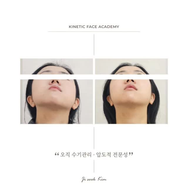 kinetic_aesthe_cheongdam 게시물 이미지: 0회,7회

단순비대칭이 아니셨던..

홈키네틱 하나하나...