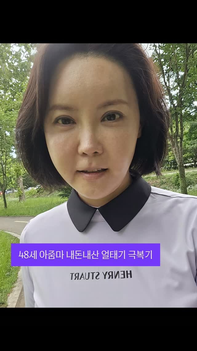 kkangddaa 게시물 이미지: 자세한 시술내용이 궁금하시면 팔로우후 DM주세요!!
#유앤미강남본점...