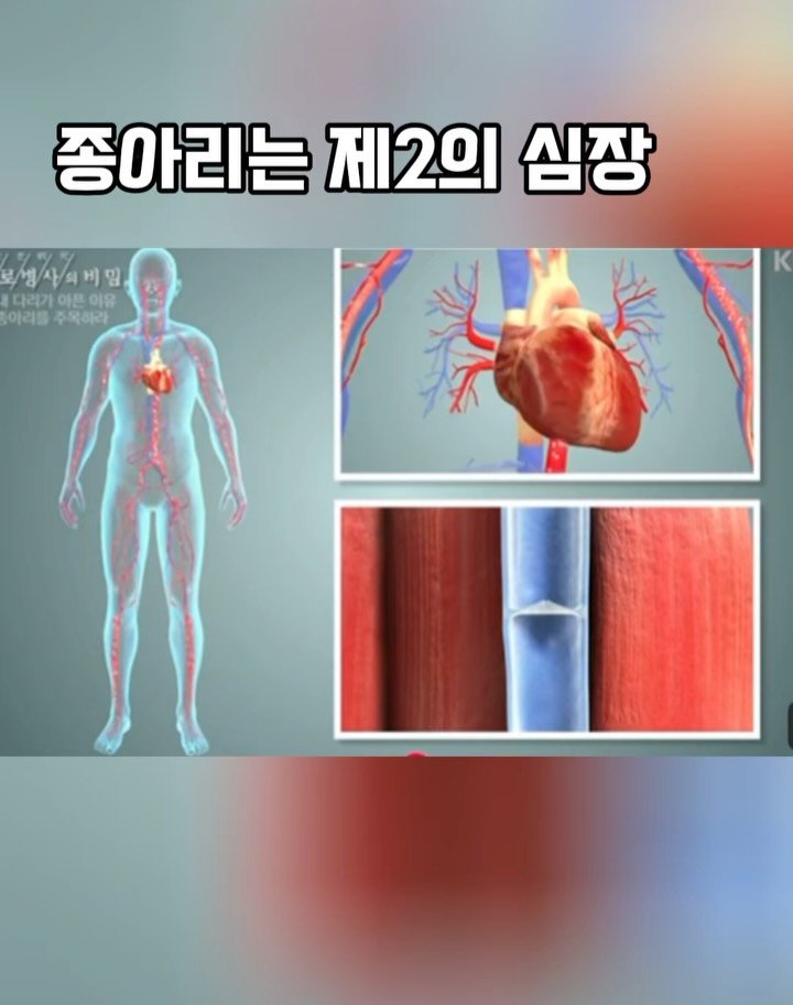 kkum.mi_homt 게시물 이미지: 압박밴드 신는 이유!
벌써 10차라니 🫣🍀 

꾸준히 신고 우리 평생 잘...