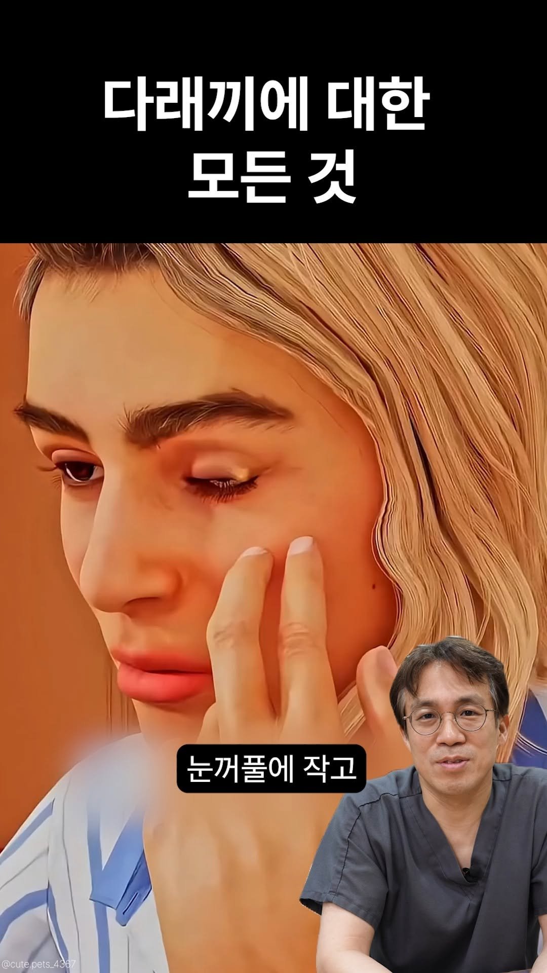 ko_losseum 게시물 이미지: 다리끼의 모든것❓

✅다래끼는 우리 눈꺼풀에 생기는 작은 염증 조직입니다 

✅눈을...