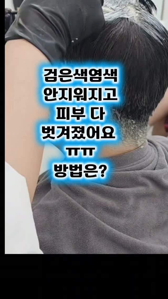kongju_zzang 게시물 이미지: 검은 염색 후 피부까지 검게 물들고, 안 지워져서 문지르다 상처 난 적...