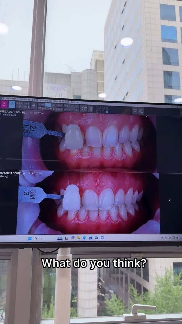 korea_clairedentalclinic_kr 게시물 이미지: I visited this dental clinic today to get my...
