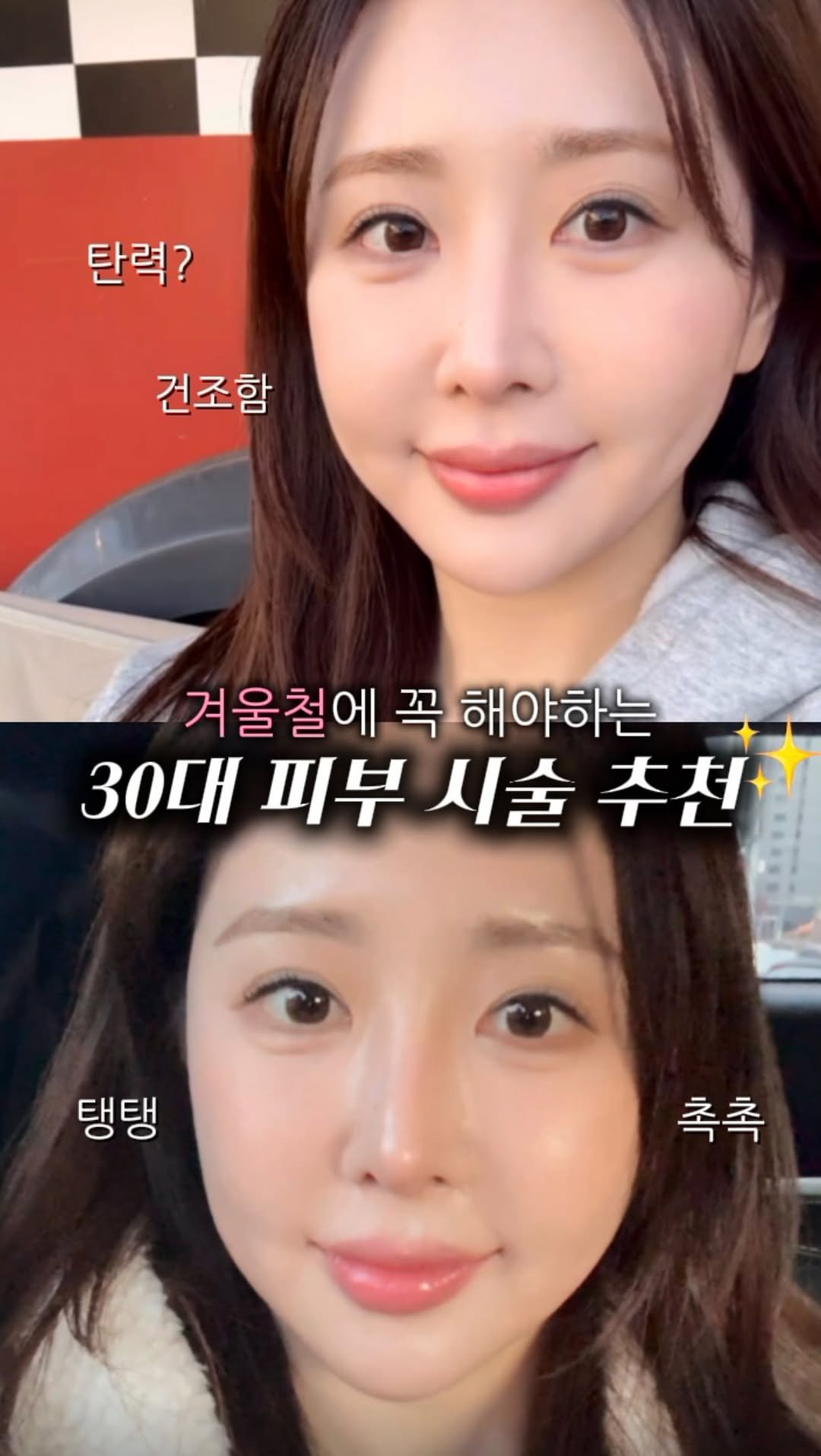 kwonshuna 게시물 이미지: 효과 미틴.. 모공+건조함에 오고 직빵!!
지금처럼 건조한 겨울철에 받으면 진짜...