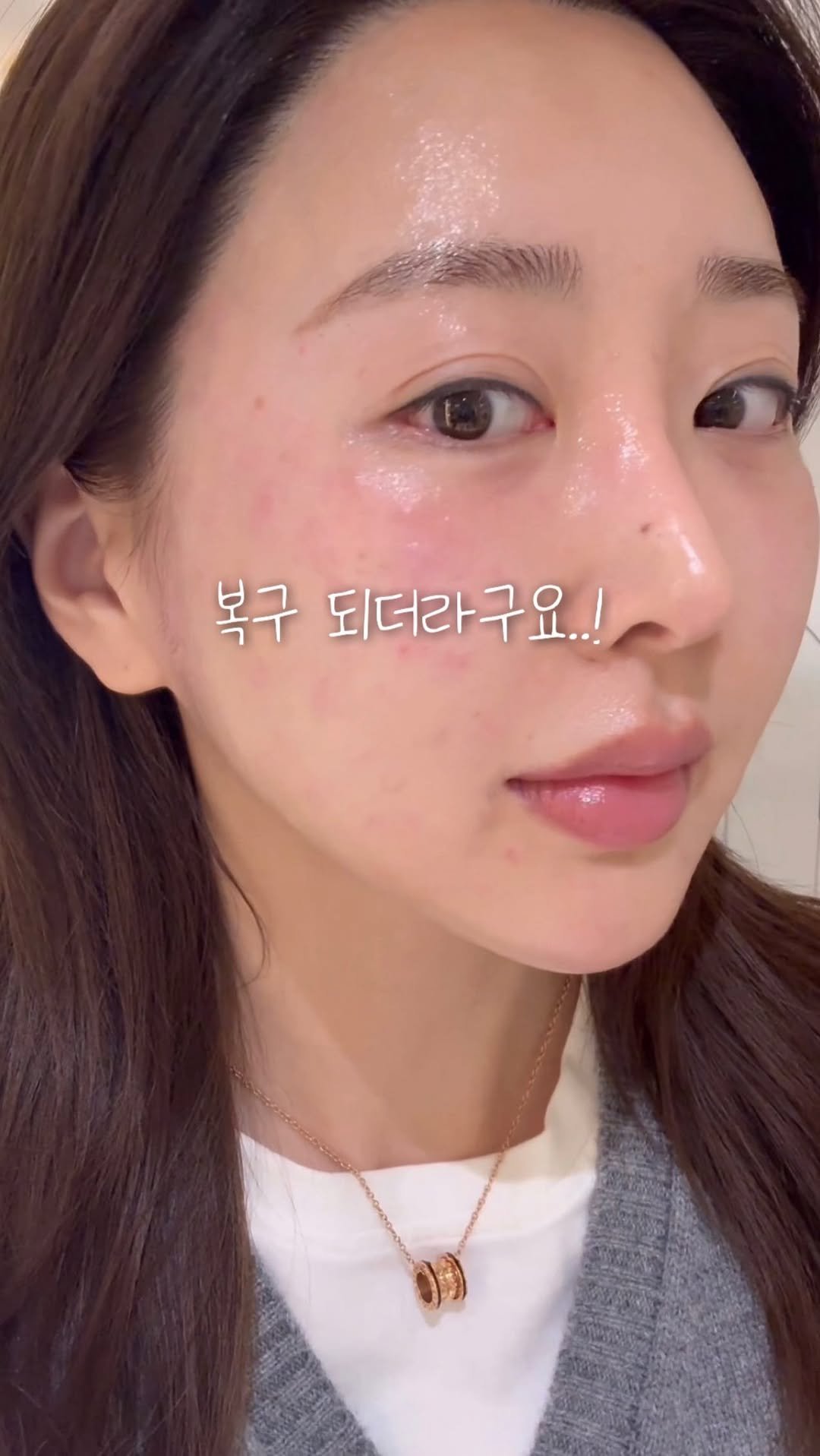 kwonshuna 게시물 이미지: 전국 8,000여개의 병의원에 입점된
부동의 1위🥇메디컬 브랜드 <이안셀>...