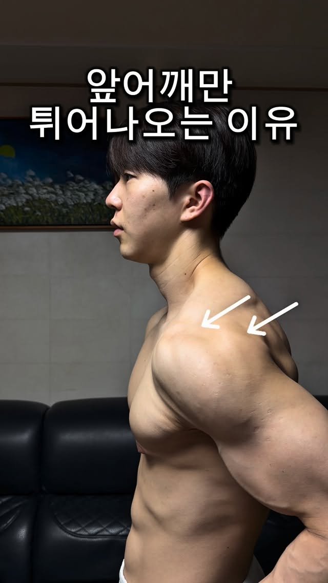 l_junghoon_ 게시물 이미지: 운동할수록 어깨 망가지는 이유 (상완골 전방활주)

등운동할때 어깨가 앞으로...