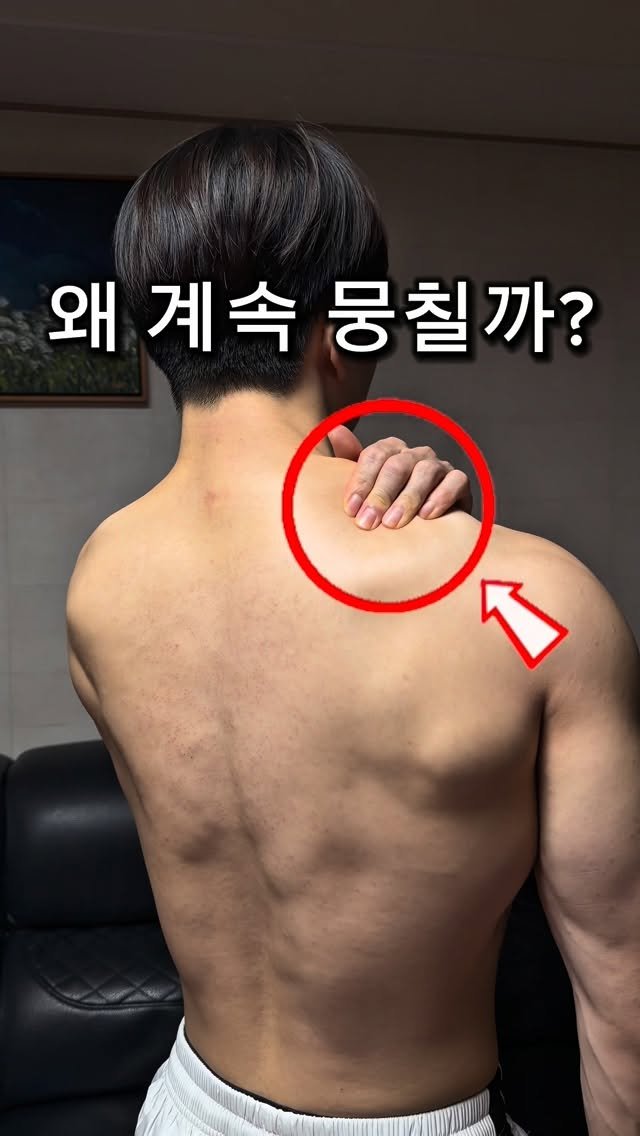 l_junghoon_ 게시물 이미지: 승모근 주물러도 게속 뭉치는 진짜 이유

매번 어개 주무르는데
왜 잠깐만 시원하고...