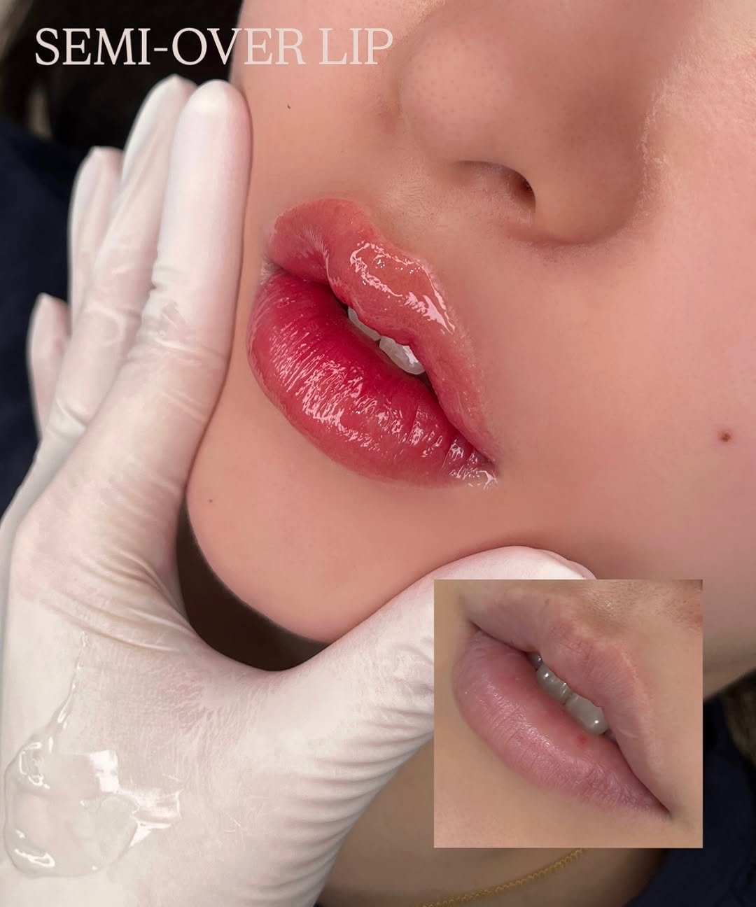 lavse_beauty 게시물 이미지: 💋 탁해보이던 입술 톤, 생기 있게 환하게 UP!
자연스러운 오버라인으로 볼륨감까지...