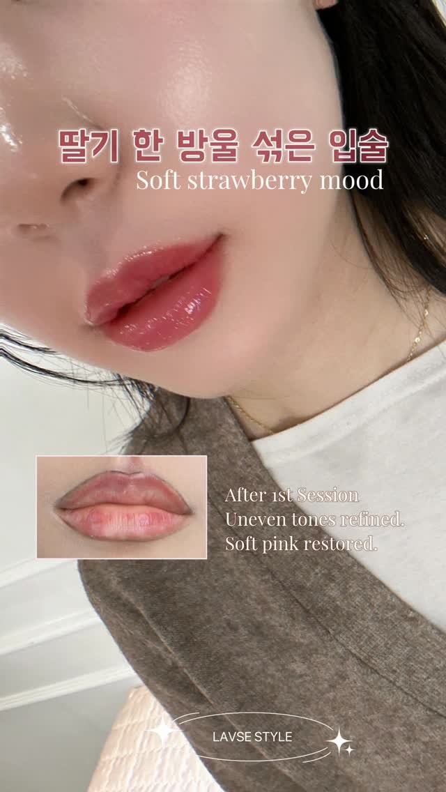 lavse_beauty 게시물 이미지: 흐릿했던 입술 라인,
고르지 않았던 톤.

1차 시술로
경계는 정리하고
자연스러운...