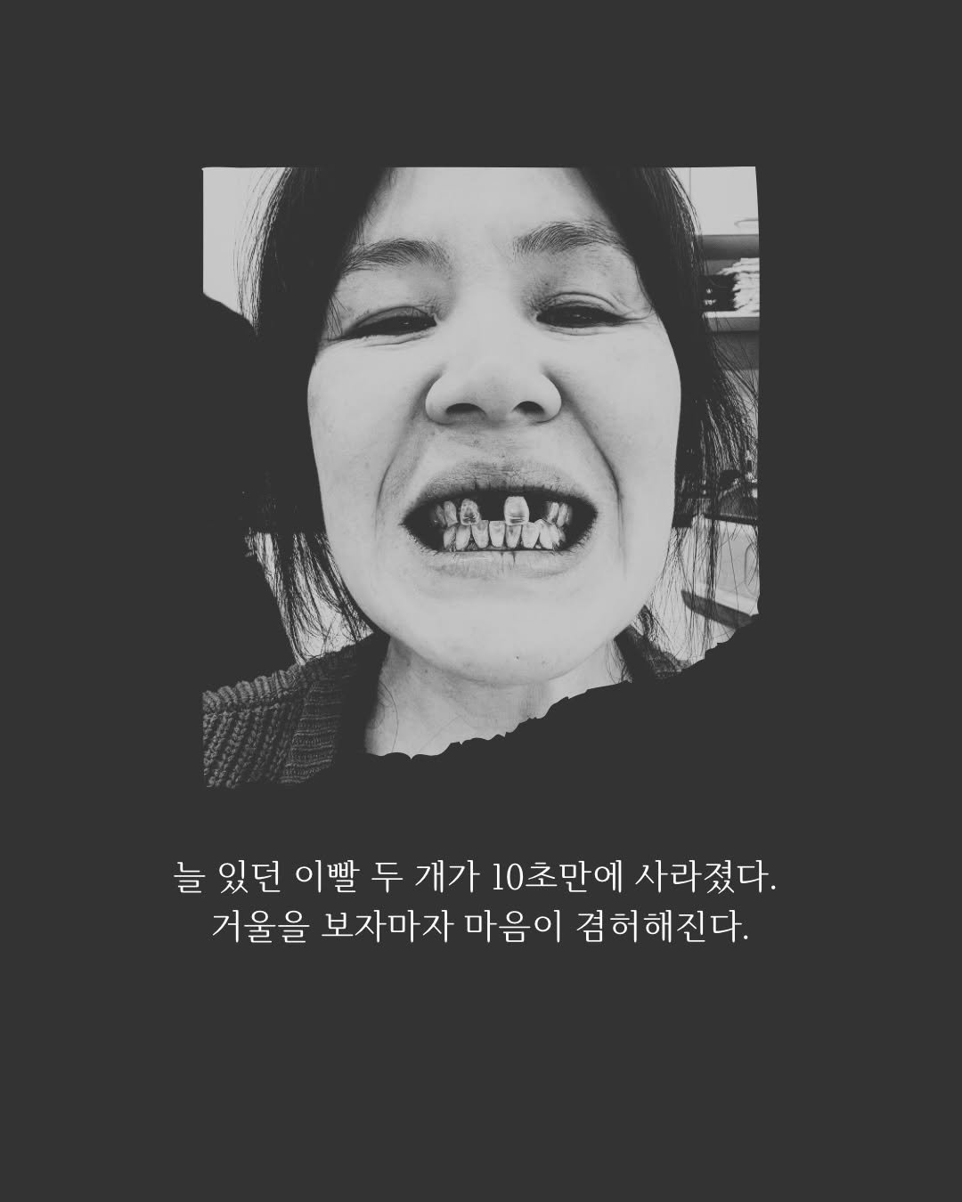 Photo by 레이지마마 리즈 on April 03, 2026. May be a black-and-white image of text that says 'Pn" 늘 있던 이빨 두 개가 10초만에 사라졌다. 거울을 보자마자 마음이 겸허해진다. 겸허해진다.'.