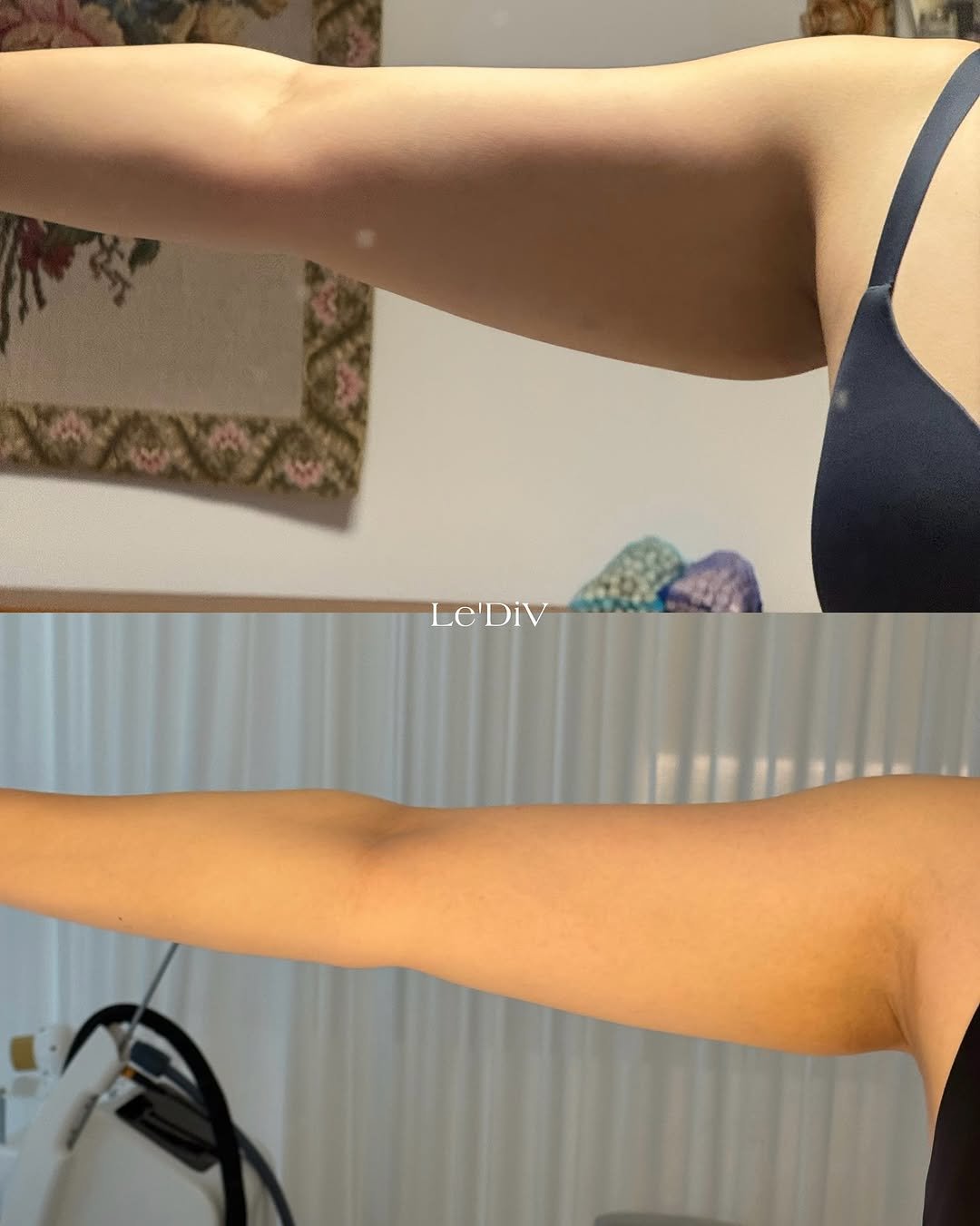 Photo by 르디브에스테틱 청담 l 웨딩케어전문 on September 16, 2025. May be an image of one or more people and biceps.