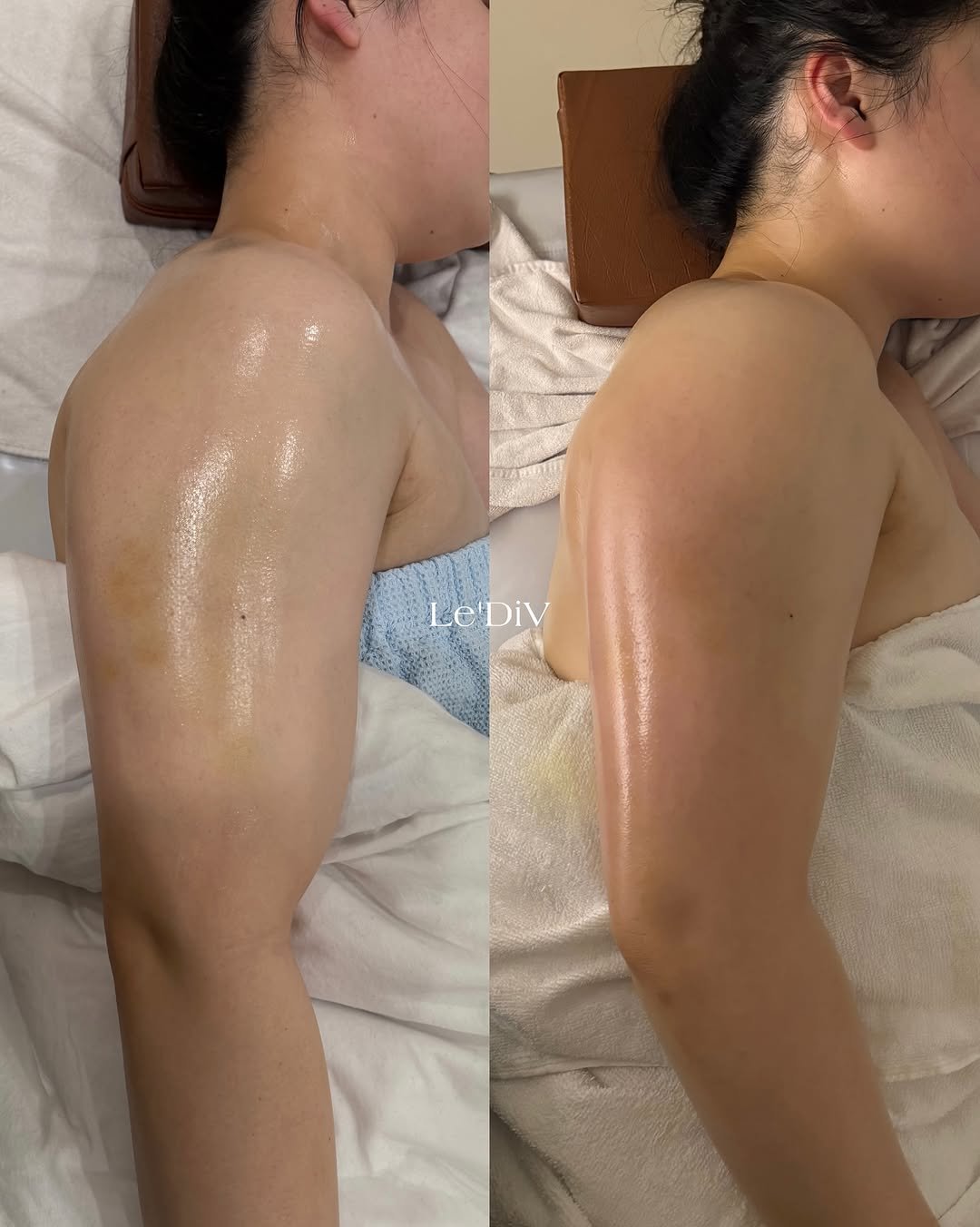 Photo by 르디브에스테틱 청담 l 웨딩케어전문 on November 15, 2025. May be an image of ‎acupuncture and ‎text that says '‎ES Le'DiV Le'l DiV ل‎'‎‎.