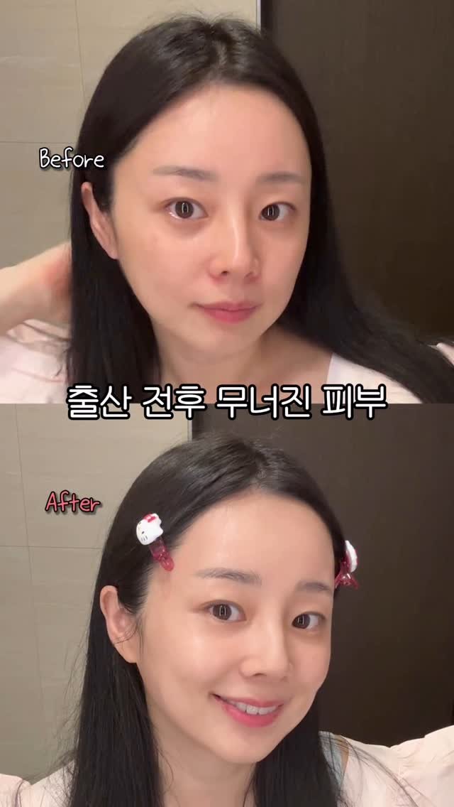 leeyooday 게시물 이미지: 출산후 피부가 또 전쟁‼️일때➡️듀이셀 세라젯❣️
피부도 근육처럼 ‘코어’가...