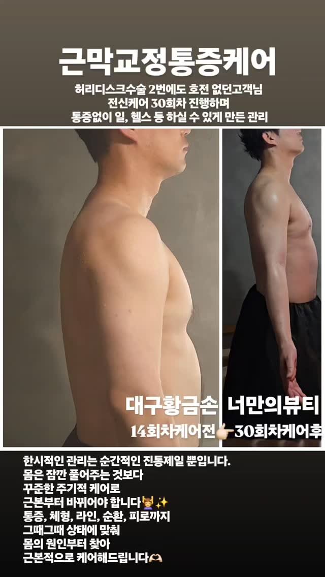 legendary_lady_jin 게시물 이미지: 변화가 뚜렸한👍🏻체감이 빠른👍🏻대구황금손의 케어
실력으로, 눈으로...