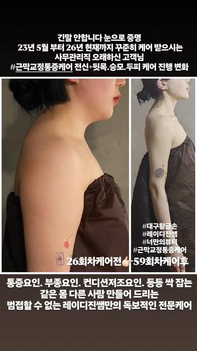 legendary_lady_jin 게시물 이미지: 근막교정통증케어 근막관리 근육관리 피로관리 체형관리 통증관리 체형교정 독소배출...