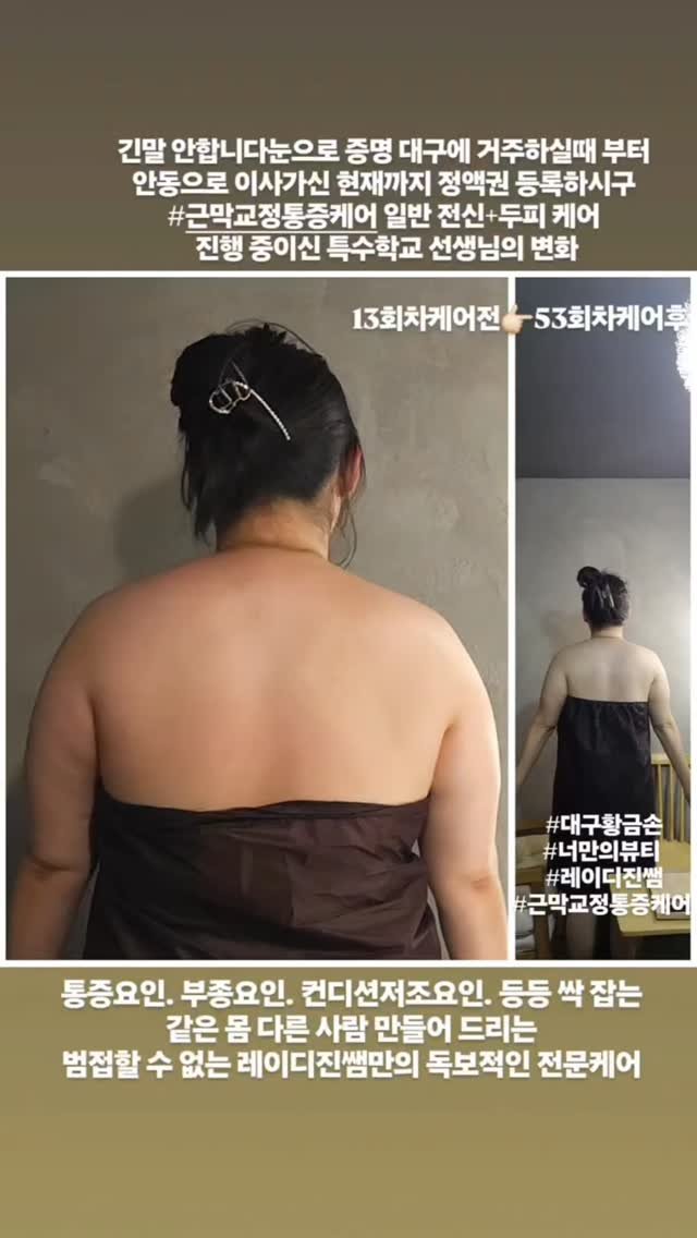 legendary_lady_jin 게시물 이미지: 근막교정통증케어 다이어트전문케어 
근막관리 근육관리 피로관리 체형관리 통증관리...
