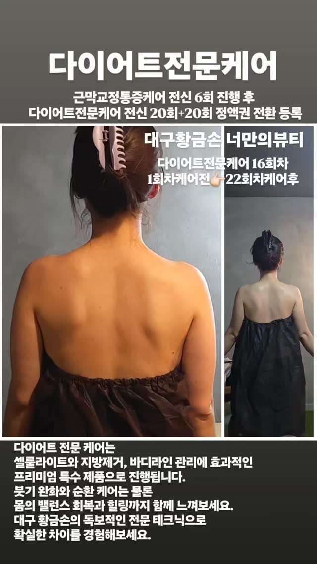 legendary_lady_jin 게시물 이미지: 변화가 뚜렸한👍🏻체감이 빠른👍🏻대구황금손의 케어
실력으로, 눈으로...