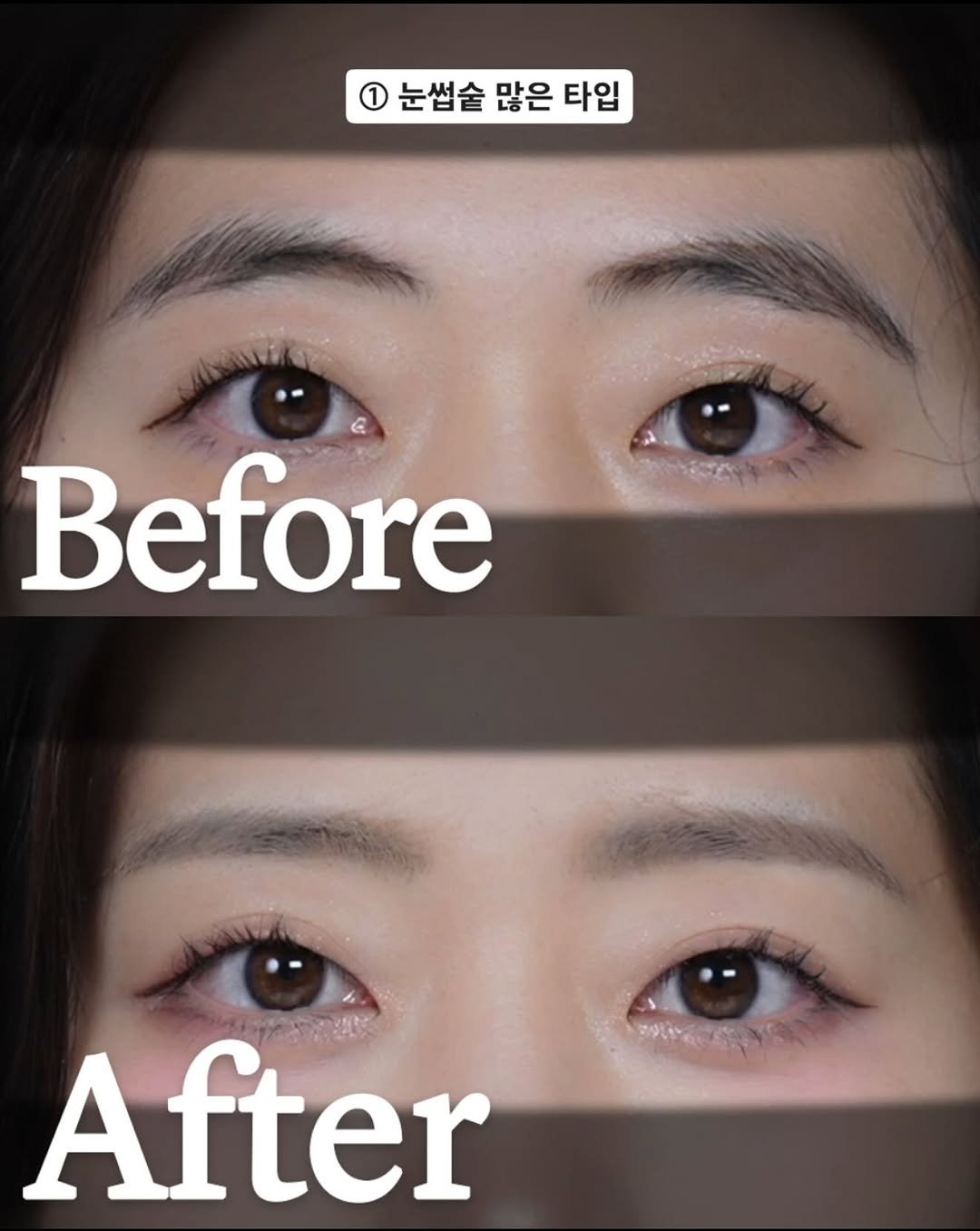 Photo by 메이크업 아티스트 레오제이 on August 26, 2025. May be an image of 2 people, eyeliner and text that says '눈썹술 많은 타입 Before After'.
