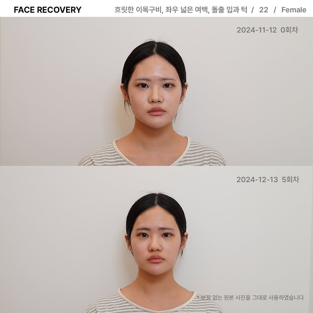 lesouffle.beaute 게시물 이미지: ⠀
⠀
르수플 리커버리는 인위적인 모습으로 변화시키지 않습니다.
⠀
고유의 개성을...
