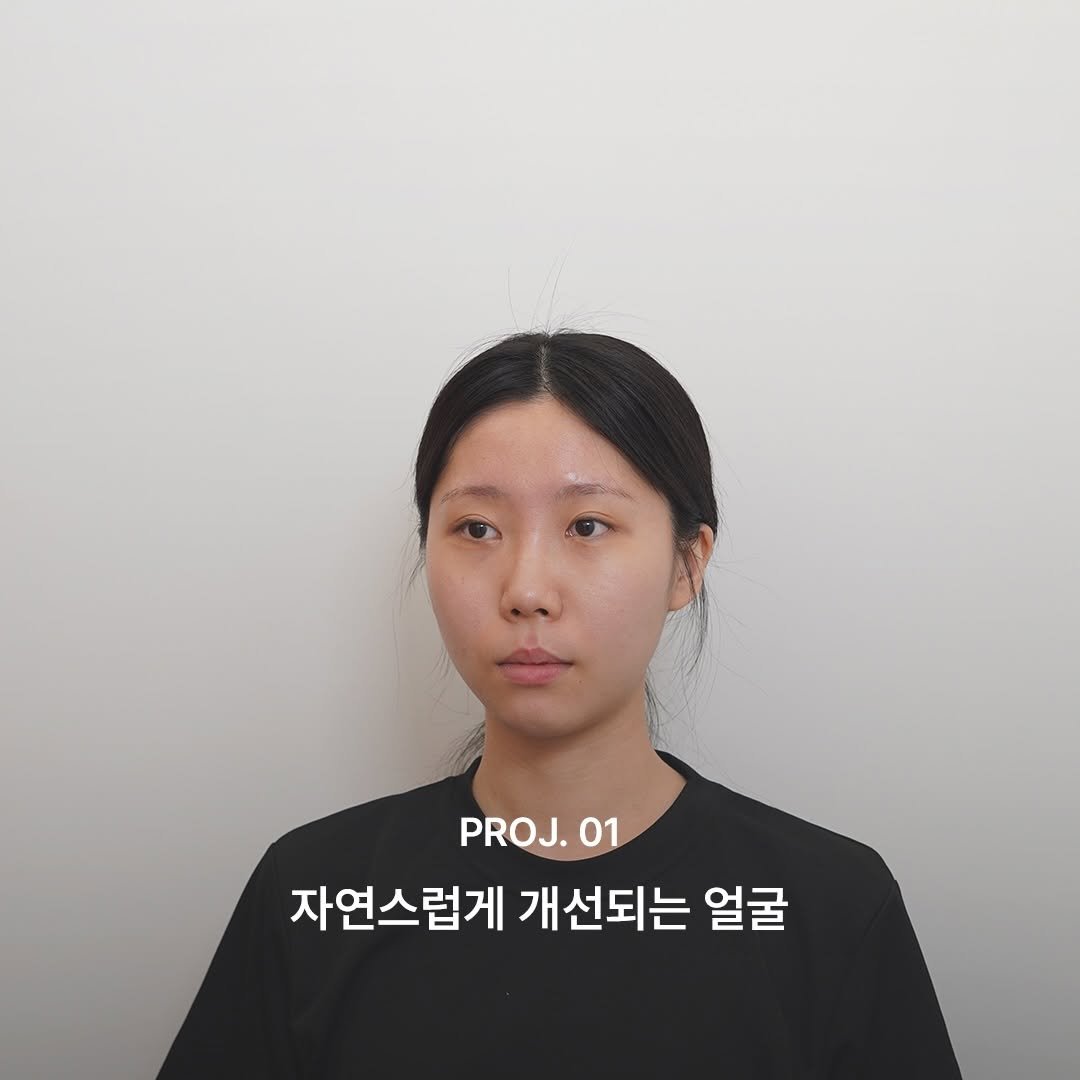 lesouffle.beaute 게시물 이미지: ⠀
⠀
브레니오(르수플 리커버리)는
기존에 알려지지 않은 접근법으로
인체의 생리적인...