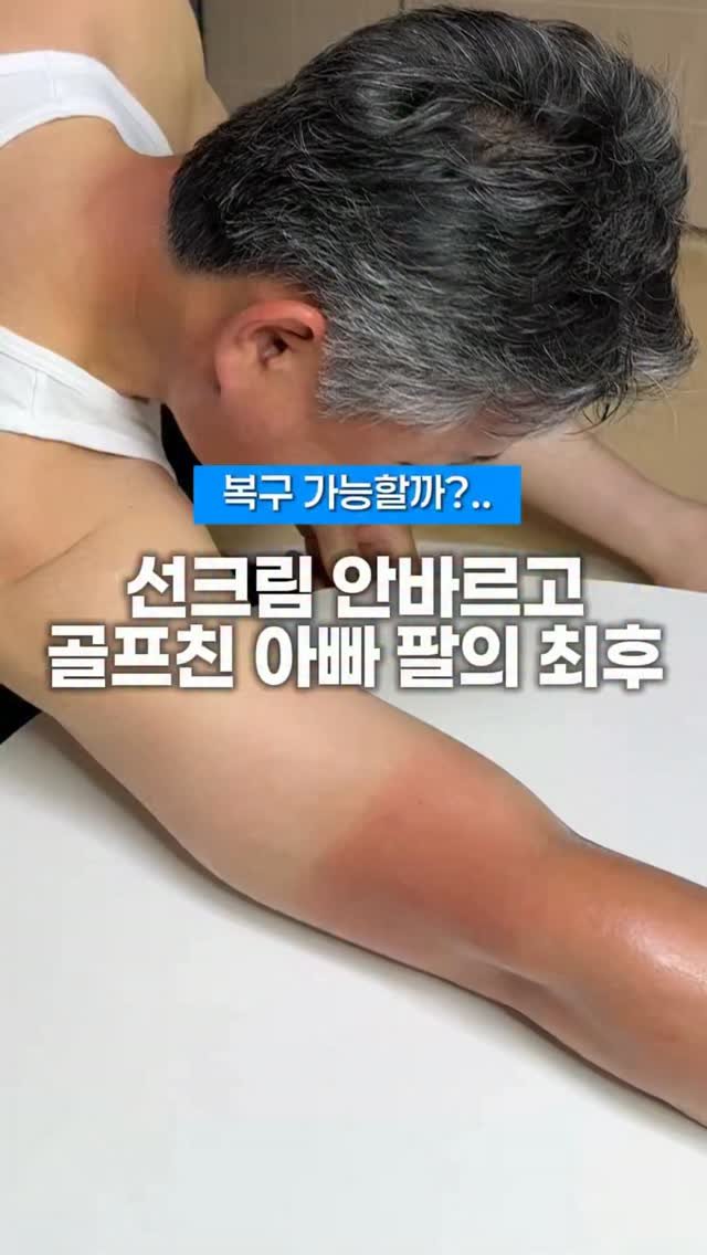 let_mein_ljh 게시물 이미지: 여름에 색소침착 주의⚠️

아빠 팔 썬번 색소 소생시켜준
쿨링겔 정보 공유
🔻댓글...