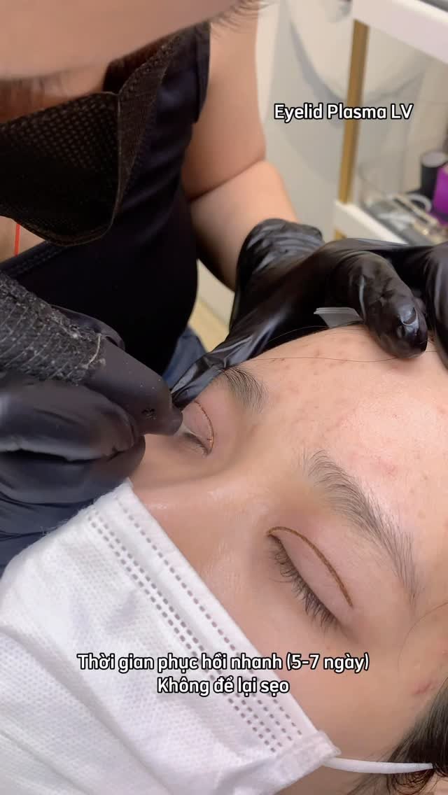 levan.nanoplasma 게시물 이미지: 🎊 TET SPECIAL – BEAUTIFUL EYELIDS 🎊
Perfectly...