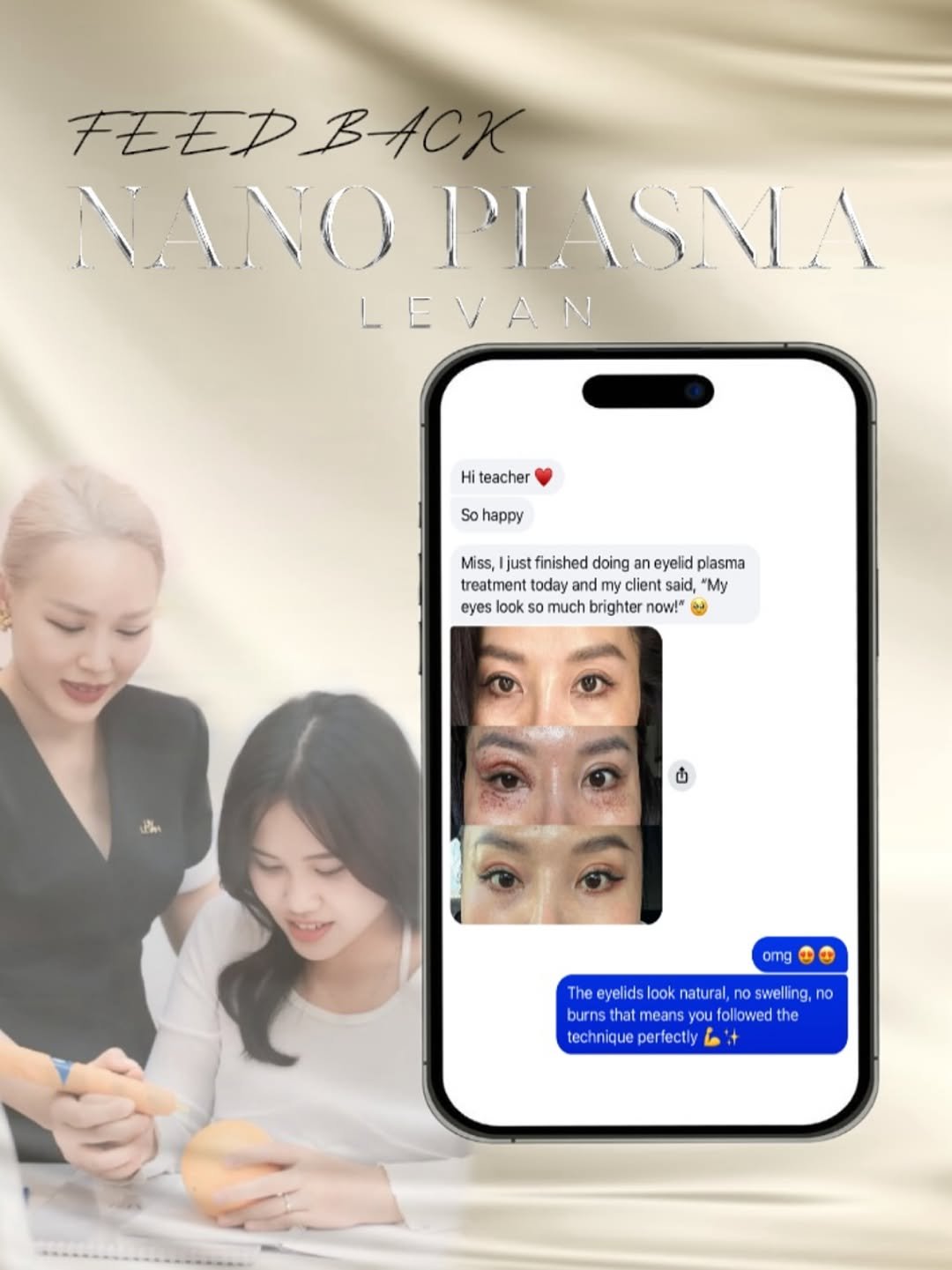 Photo by Levan.NanoPlasma on November 01, 2025. May be an image of one or more people, fingernails, poster and text that says 'FEEDBACK FEEP BAcΚ NANO PIASNA LEVAN Hi teacher So happy Miss, just finished doing eyelid plasma treatment today and dmy client said, "My eyes look So much brighter now!" పీ omng The yel Thejlrdsloknktraroselin dslook natura n swelling,no no burr means lowedt he techniqueperfectly tech erfectly 6'.