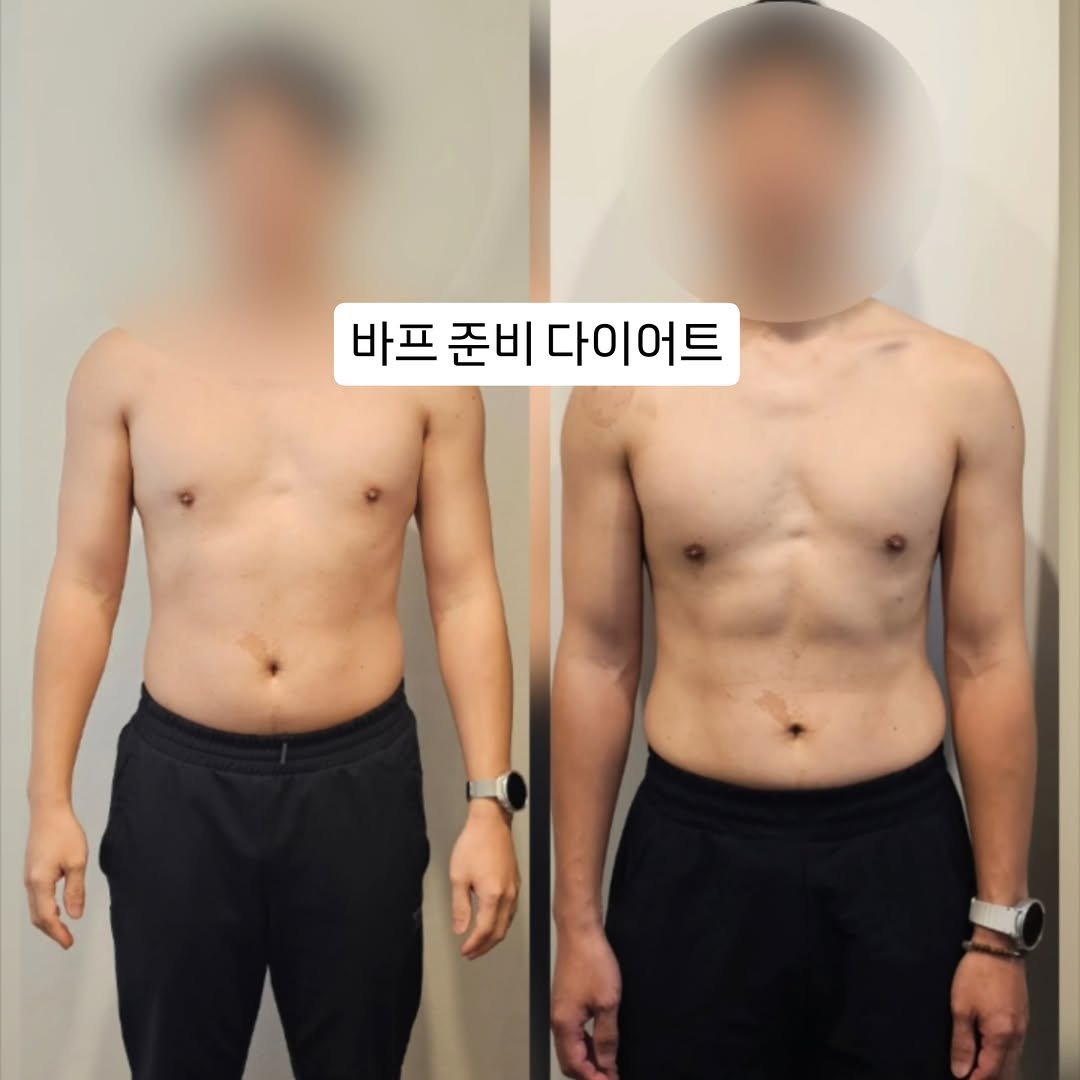 lifechange1_official 게시물 이미지: 바프까지 약 2개월 반 정도 남은 현재

처음 사진과 비교하면 라인이 많이 달라지고...