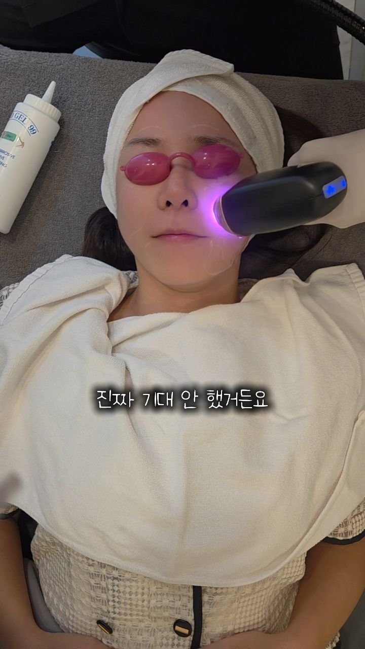 lovee_ha 게시물 이미지: #내돈내산 중안부축소리프팅 받으러갔다가 얼굴면적까지 줄인썰💓
‼️댓글에 [리프팅]...