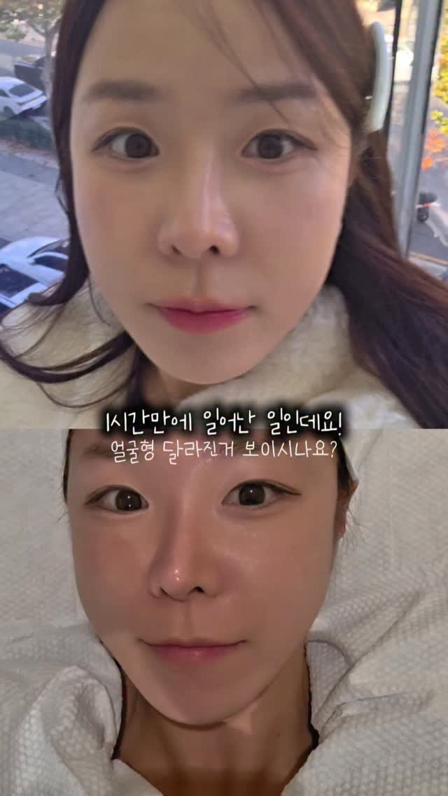 lovee_ha 게시물 이미지: 댓글에 [리프팅콤보] 남겨주시면 정보 드릴게요‼️

중요한 스케줄 앞두고 있다면 이...