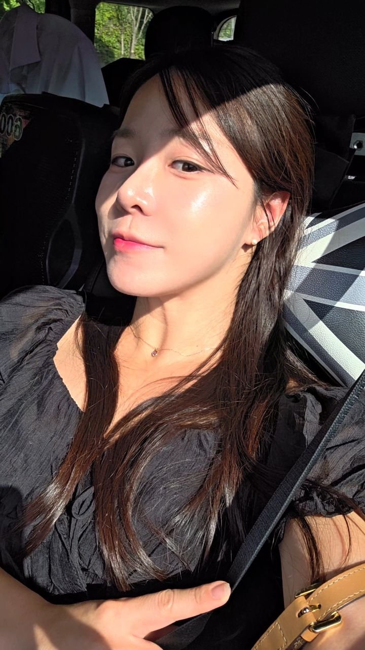 lovee_ha 게시물 이미지: #제휴 저처럼 웃을때 양옆 살 불룩하게 올라오ㅏ서 팔자가 더 진해지는 분들은...