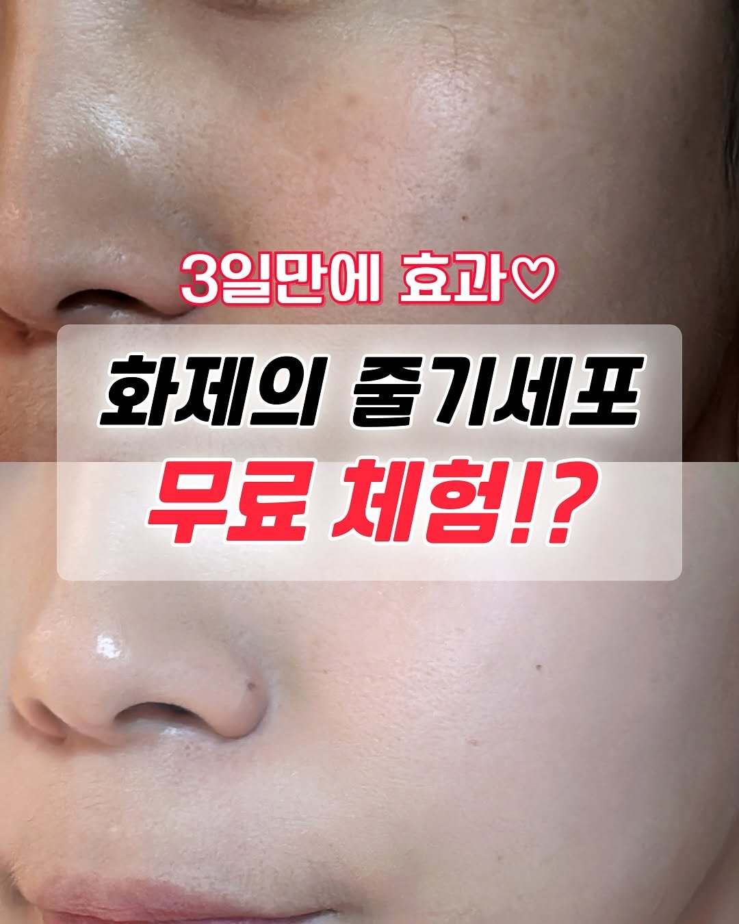 Photo shared by 박혜진 ㅣ 지아,지유 (아유맘)👧🏻 on September 30, 2025 tagging @_ellejou_. May be an image of 1 person and text that says '3일만에 효과 화제의 줄기세포 무료 무료체험 체험!?'.