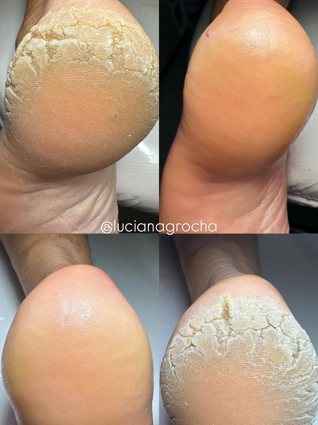 Photo by Luciana Rocha | Estética dos Pés / D’Epilação & Sobrancelhas in Studio Luciana Rocha. May be an image of one or more people, fingernails and text.