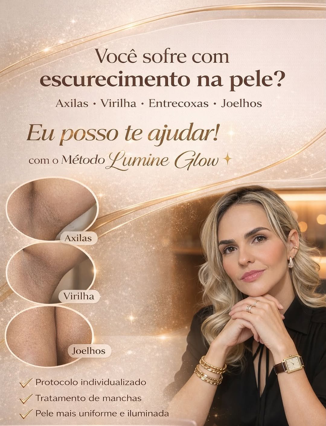 Photo by Luciana Rocha / D’Epilação / Sobrancelhas / Estética dos Pés in Studio Luciana Rocha with @lucianagrocha. May be an image of one or more people, hair, fingernails, sink, poster and text that says 'Você sofre com escurecimento na pele? Axilas• Virilha• Entrecoxas Joelhos Eu posso te ajudar! com O Método Lumine Glow Axilas 2 Virilha Joelhos Protocolo Individualizado Tratamento de manchas Pele mais uniforme e iluminada'.