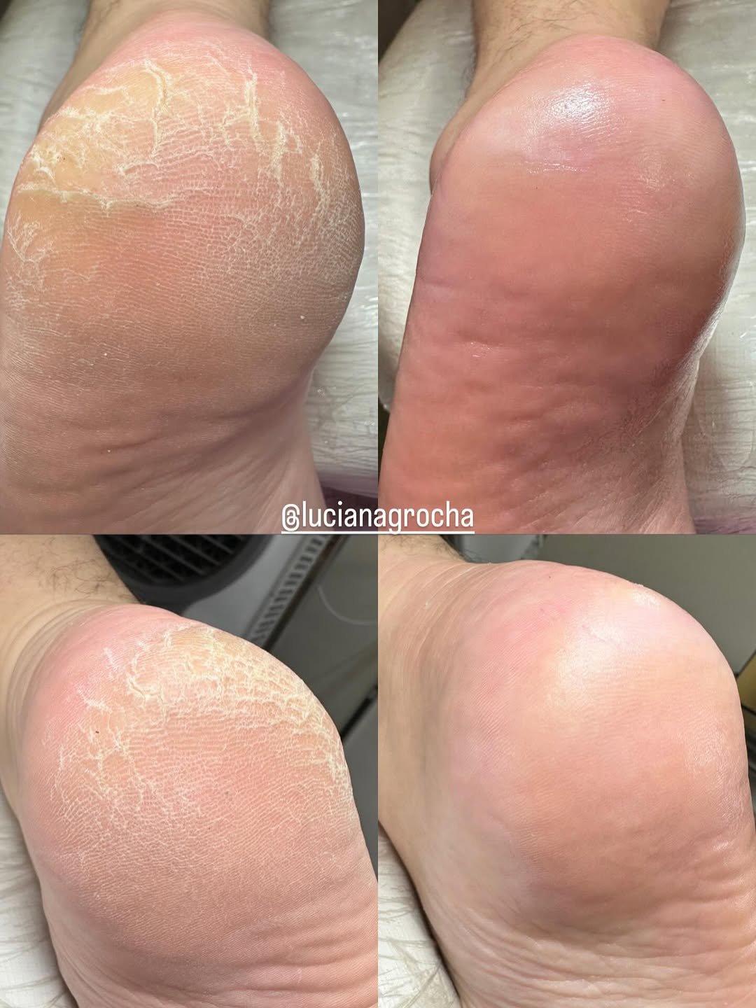 Photo by Luciana Rocha | Estética dos Pés / D’Epilação & Sobrancelhas in Studio Luciana Rocha with @luciana.grocha. May be an image of text.